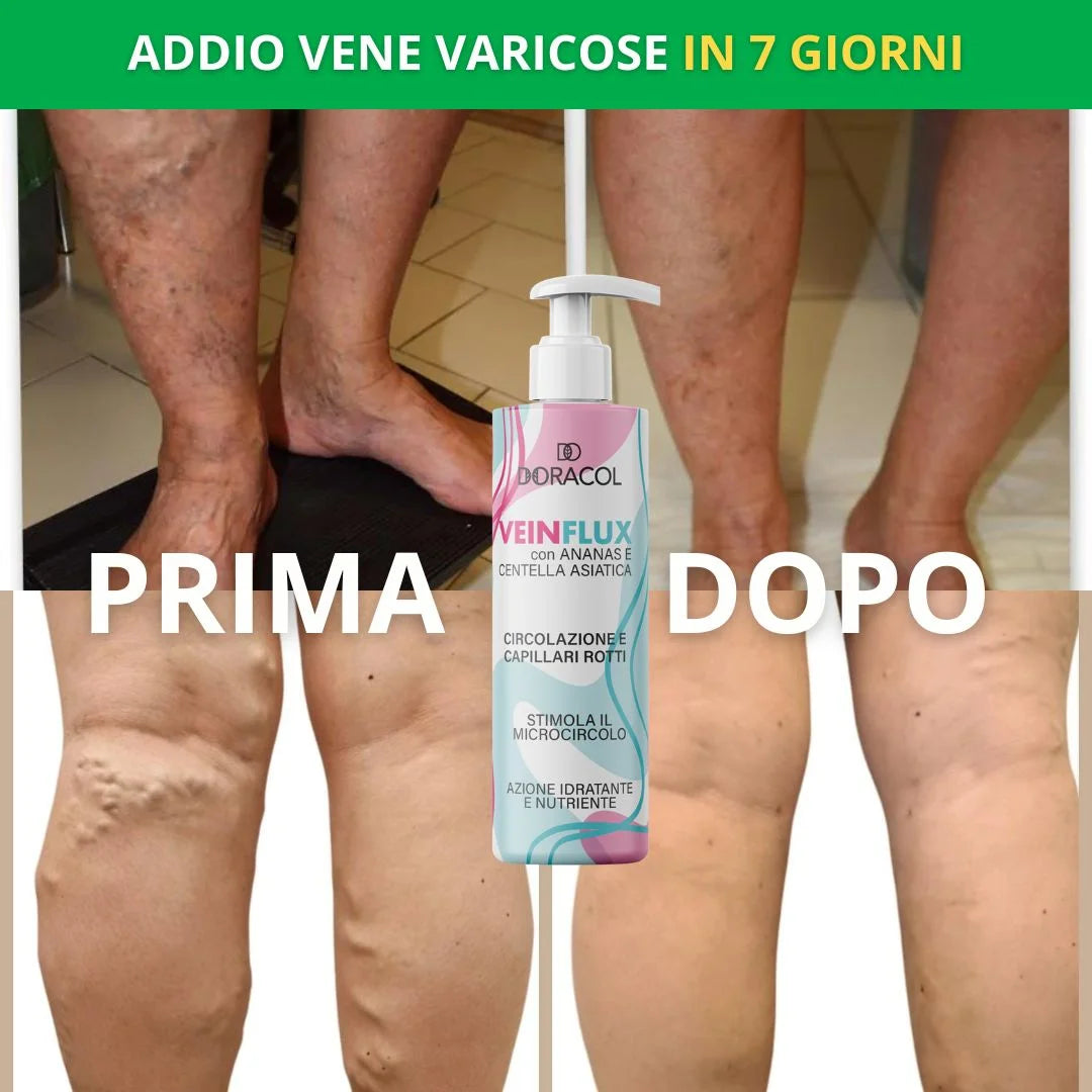 VEINFLUX – Prendi 2 al prezzo di 1 Offerta limitata!